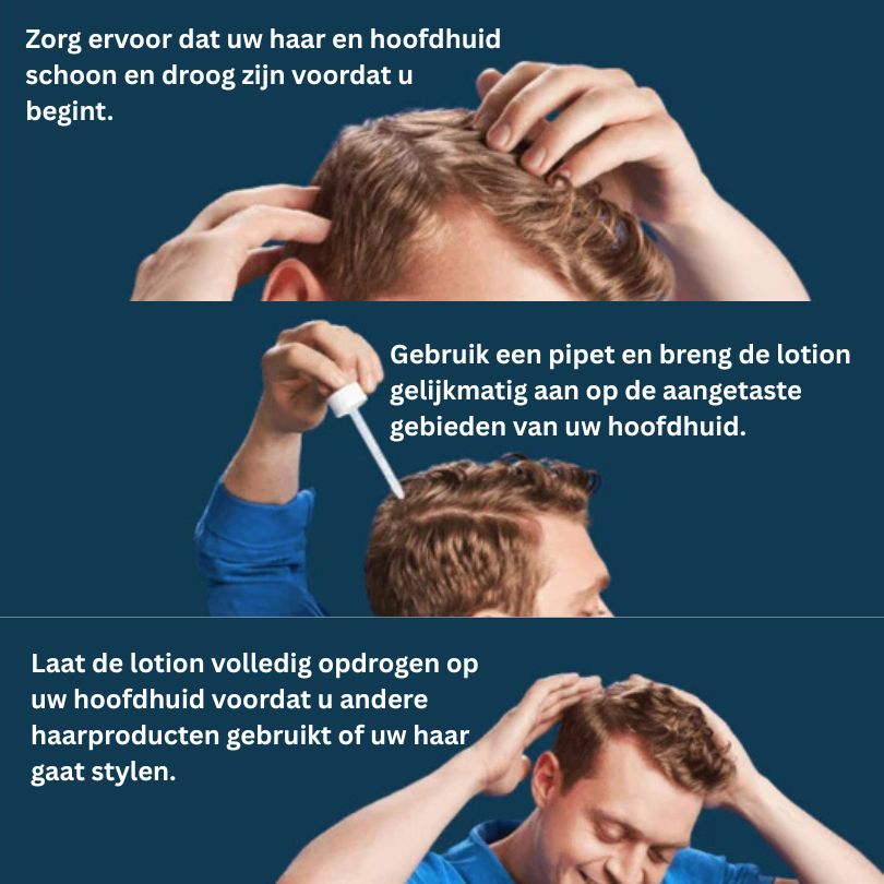 Kirkland™ Minoxidil 5% – Voor Sterker, Dikker & Vol Haar