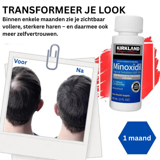 Kirkland™ Minoxidil 5% – Voor Sterker, Dikker & Vol Haar
